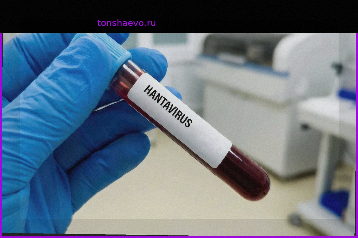 Хантавирус на борту MV Hondius: Мутировал ли вирус Анд? Вердикт Института Пастера